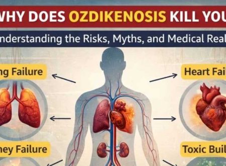 Ozdikenosis Kill You